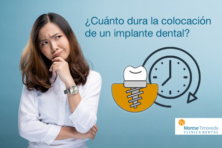 implantes dentales | tiempo de colocación