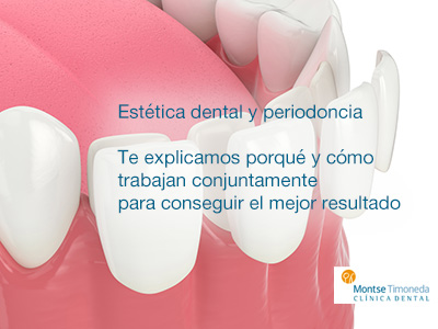 estetica dental y periodoncia en Tarragona