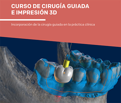 curso de cirugía guiada e impresión 3D en clínica dental Montse Timoneda