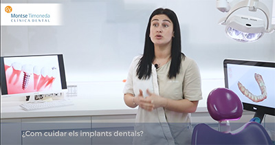 todo lo que debes saber sobre el mantenimiento de los implantes dentales