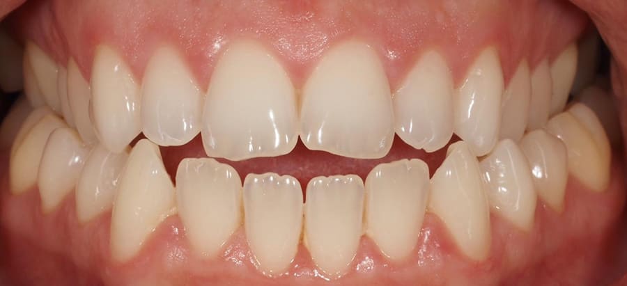 Before image
