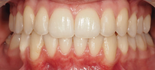 After image