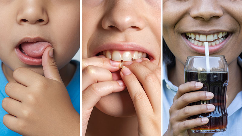 concienciacion sobre habitos orales dañinos y diastema