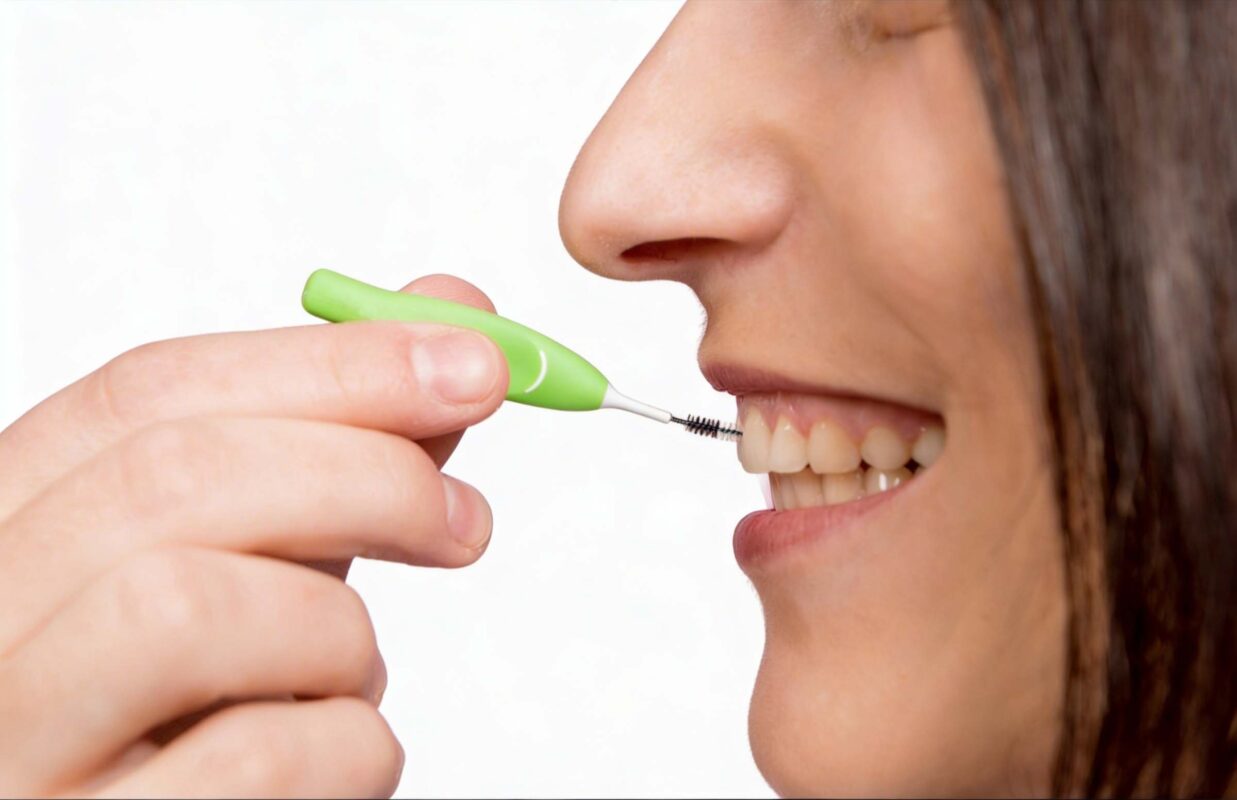 cepillos interdentales | periodontitis tratamiento