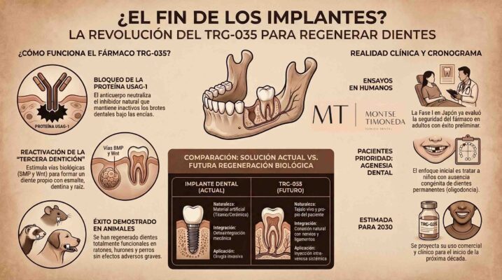 infografia de clinica dental Montse Timoneda sobre el TRG-035