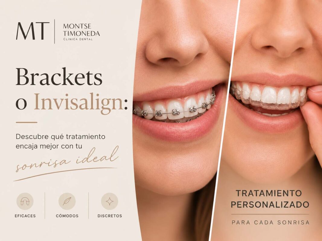 invisalign y brackets en clinica dental montse timoneda | Brackets o Invisalign Descubre que tratamiento encaja mejor con tu sonrisa