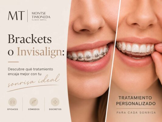 invisalign y brackets en clinica dental montse timoneda | Brackets o Invisalign Descubre que tratamiento encaja mejor con tu sonrisa