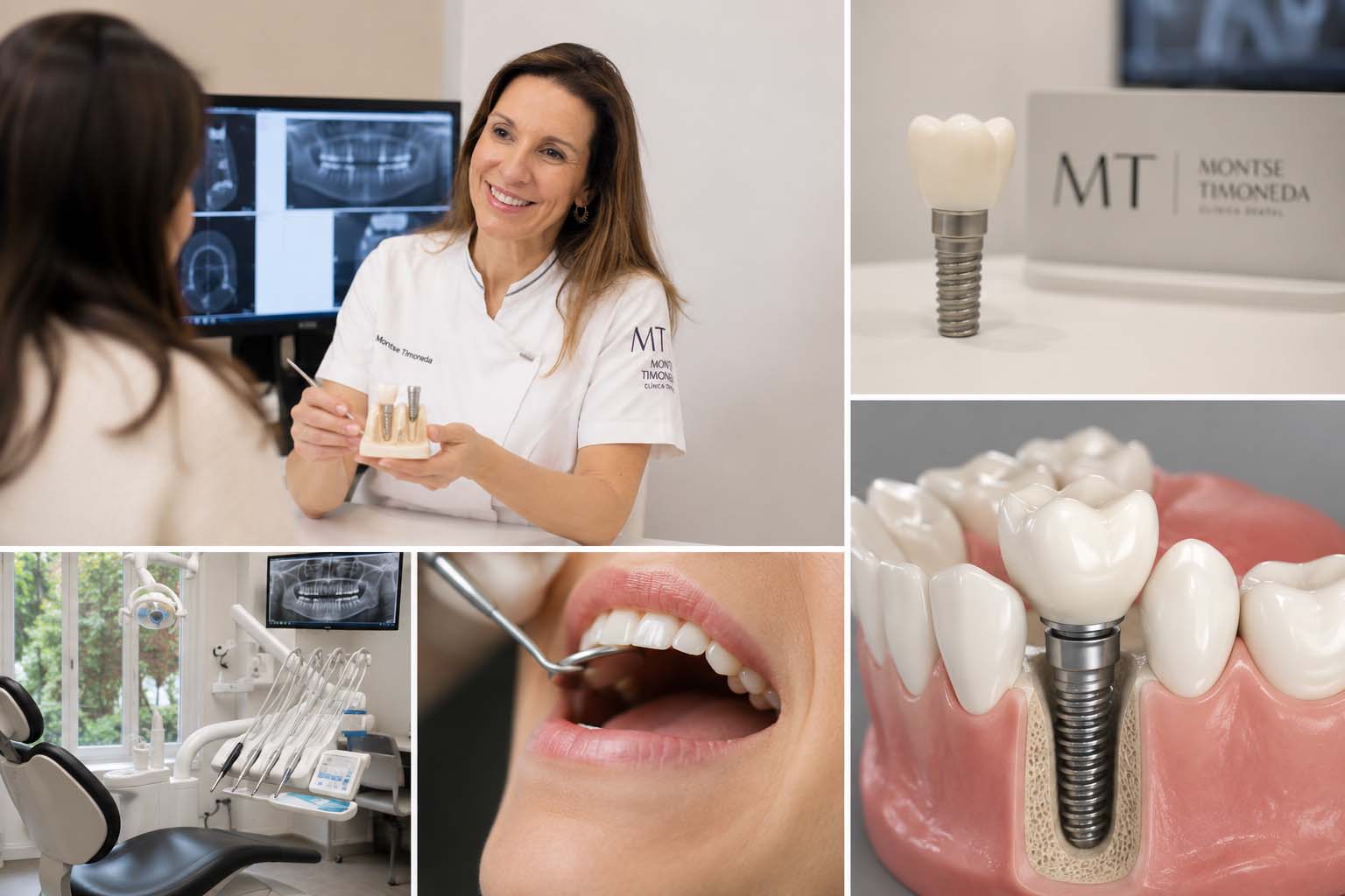 Preguntas frecuentes sobre implantes dentales | Implantes dentales en Tarragona recupera tus dientes fijos con un tratamiento personalizado