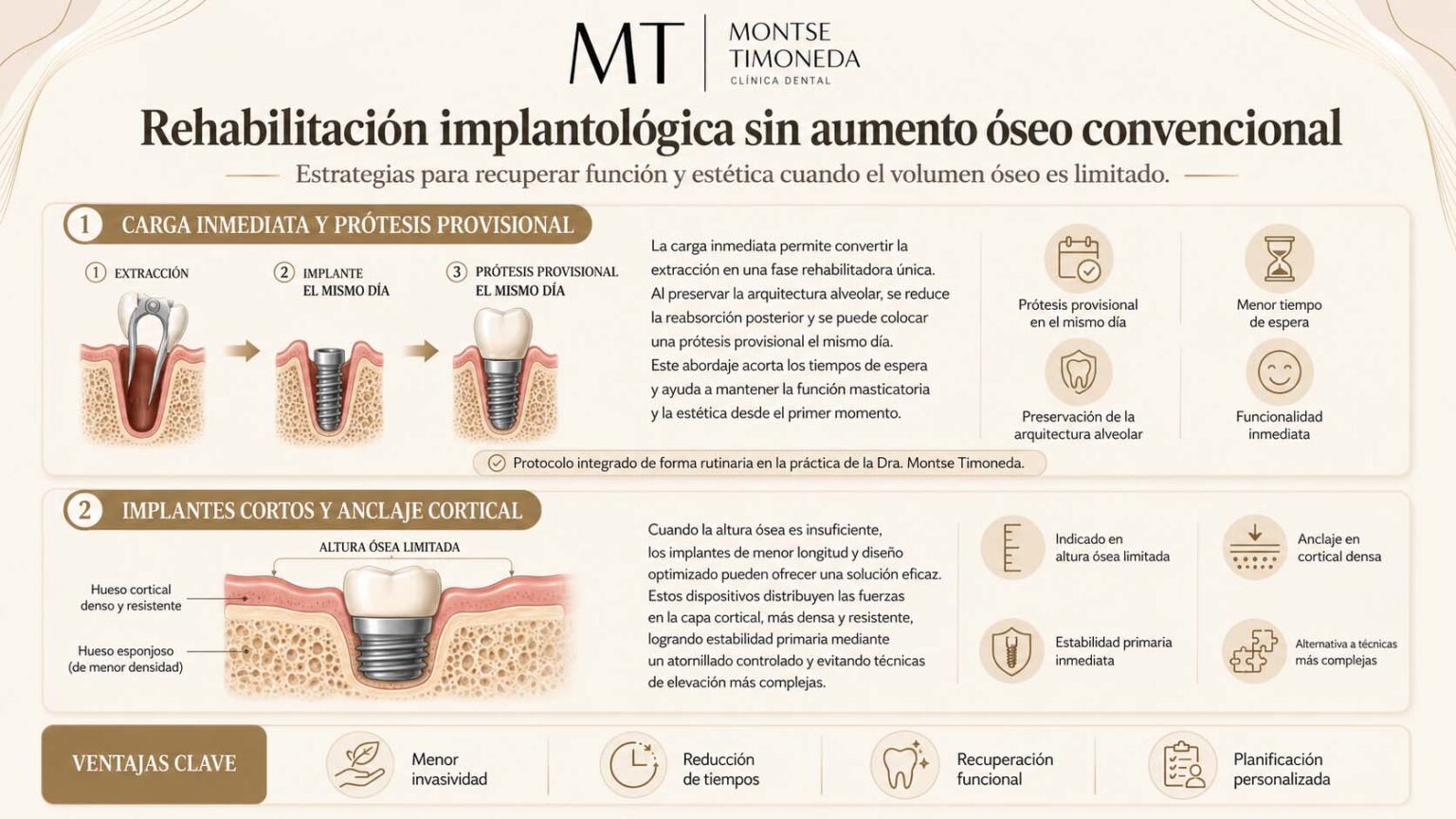 Implantes de menor longitud y anclaje cortical como opcion quirurgica | Injerto oseo para implantes dentales cuando es necesario y que alternativas existen