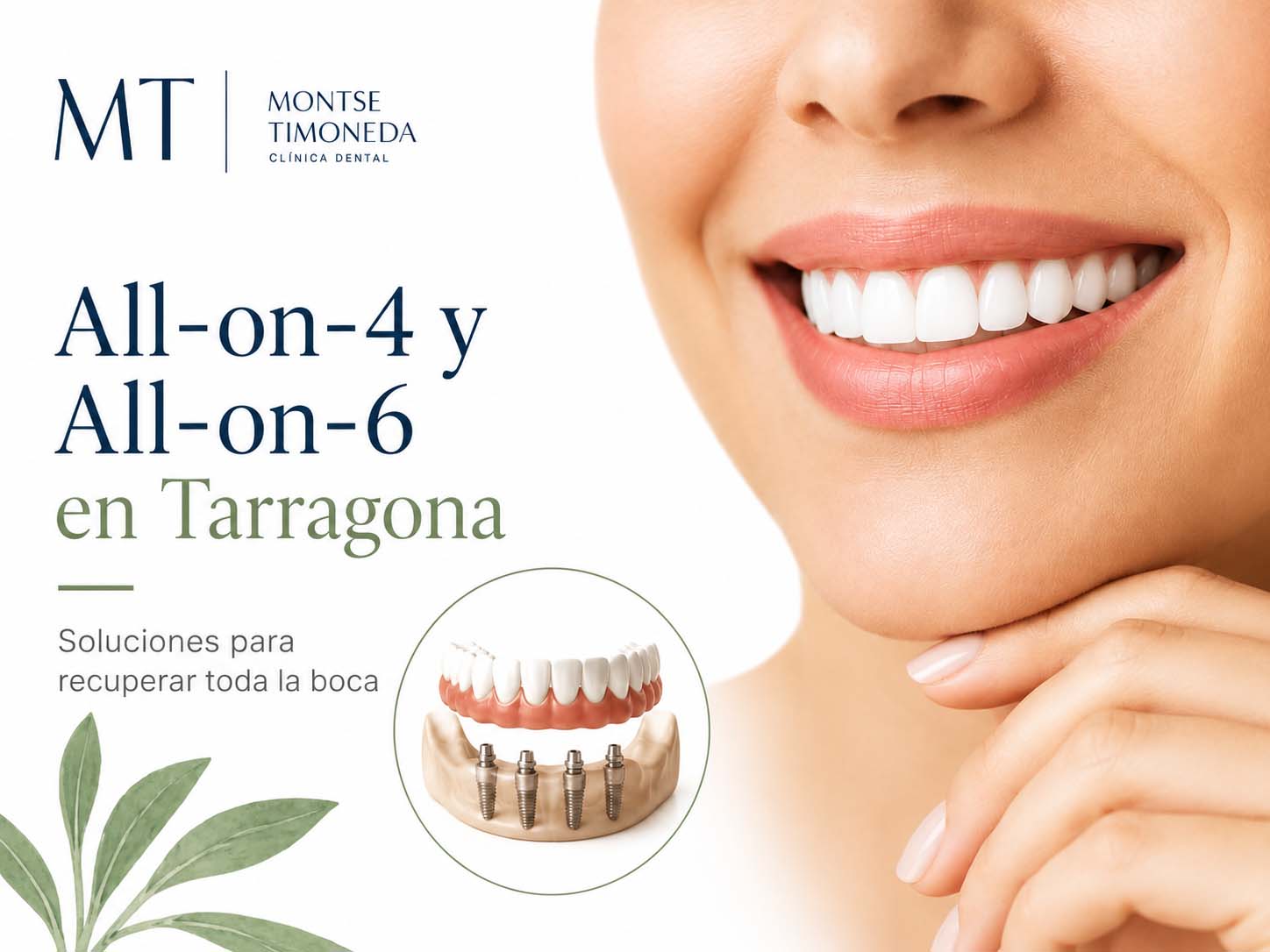 implantes dentales en tarragona clinica dental implantologia | All on 4 y All on 6 en Tarragona soluciones para recuperar toda la boca
