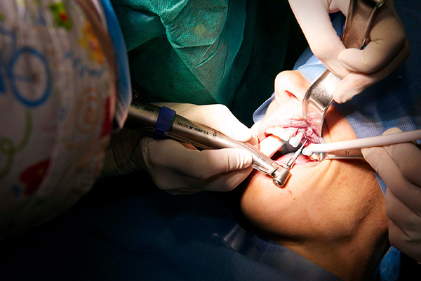 cirugia de implantes
