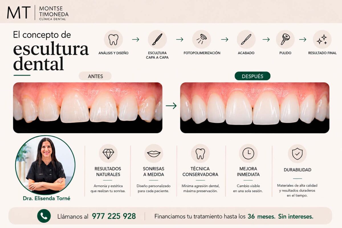 infografia sobre el concepto de escultura dental clinica dental montse timoneda| carillas de composite