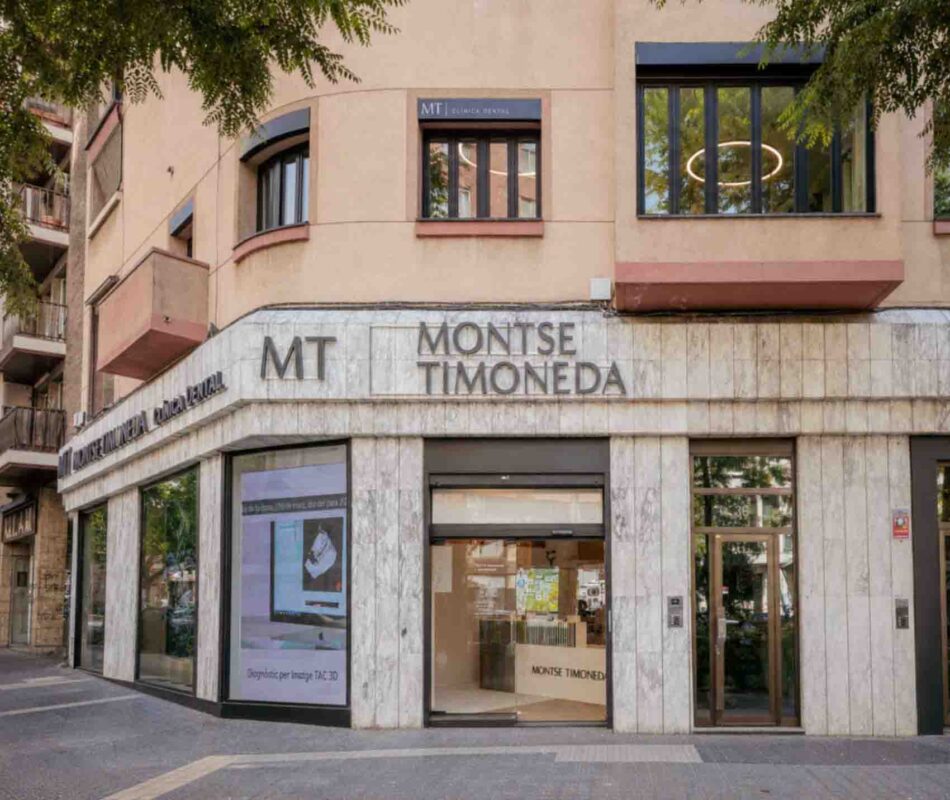 Quieres saber si las carillas de composite son adecuadas para ti en tarragona