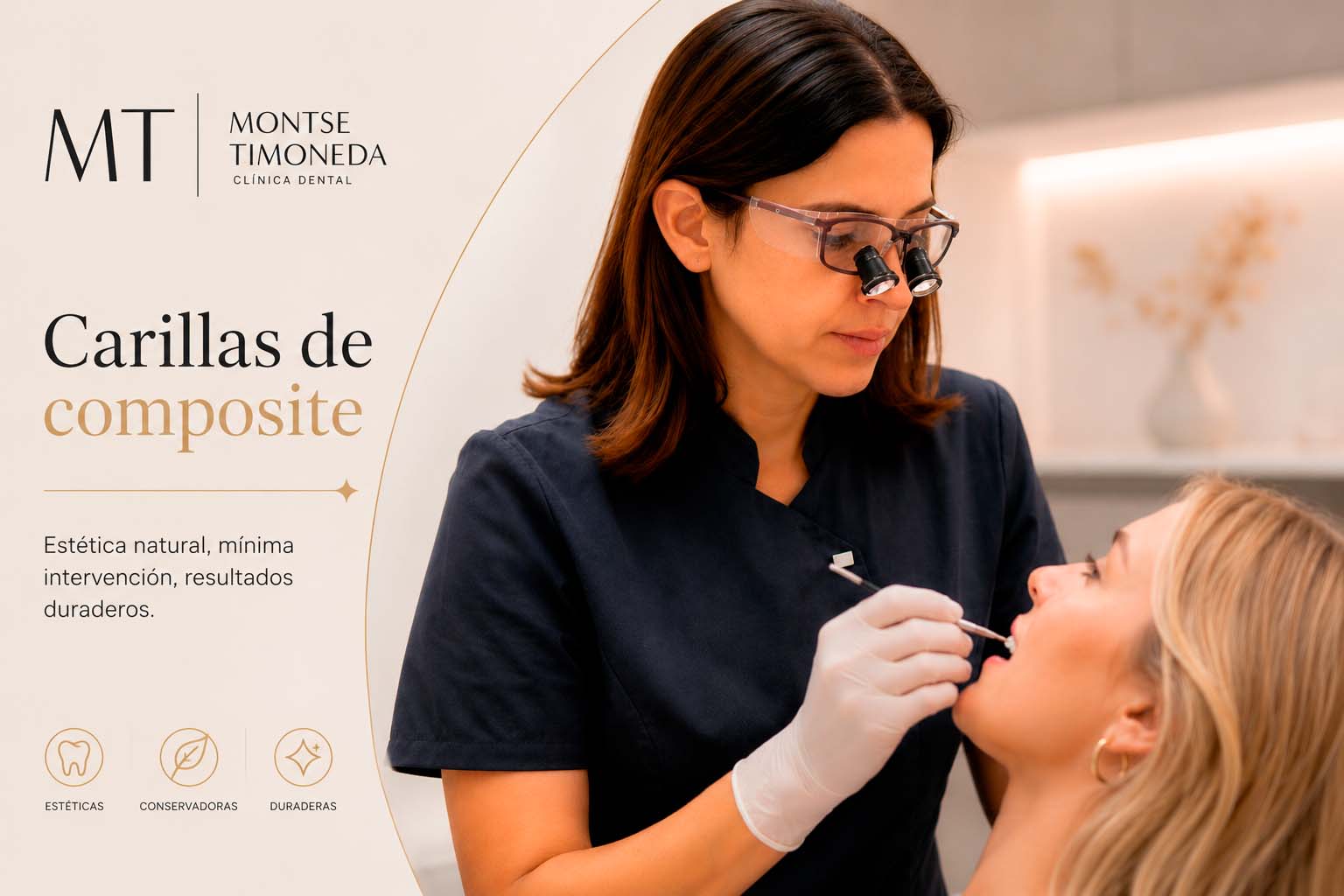 carillas de composite en clinica dental montse timoneda