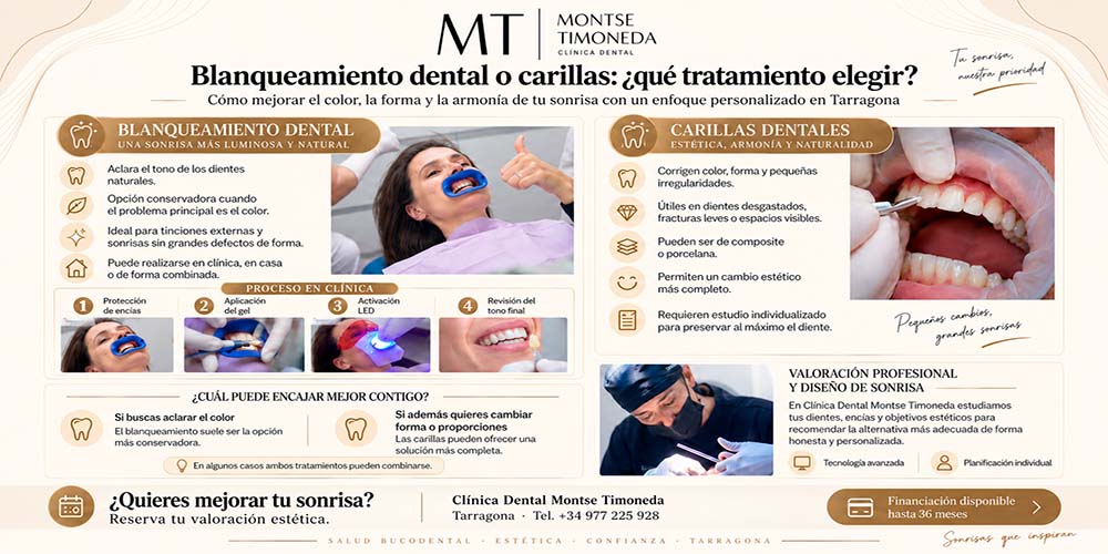 infografia de clinica dental montse timoneda sobre Blanqueamiento dental o carillas que tratamiento elegir para mejorar tu sonrisa