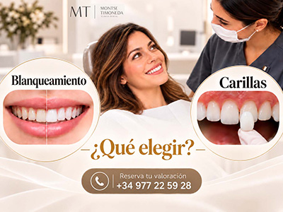 que deberia hacerme de estetica dental | Blanqueamiento dental o carillas que tratamiento elegir para mejorar tu sonrisa
