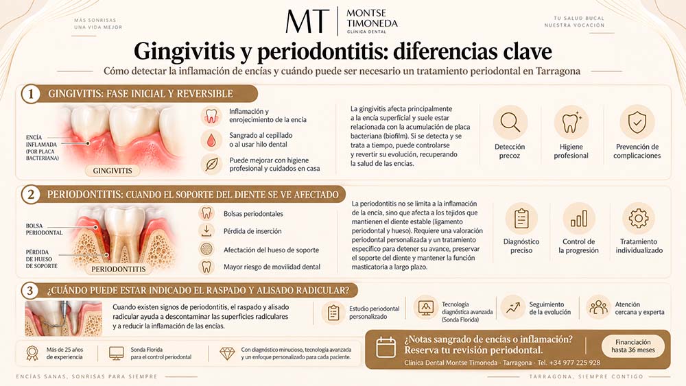 gingivitis frente a periodontitis | Limpieza dental en Tarragona cada cuanto hacerla y cuando es necesario un curetaje
