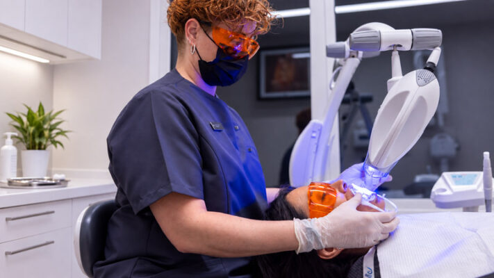 Cuándo realizar un blanqueamiento antes de las carillas | Blanqueamiento dental o carillas que tratamiento elegir para mejorar tu sonrisa