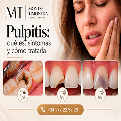 pulpitis tarragona tratamiento