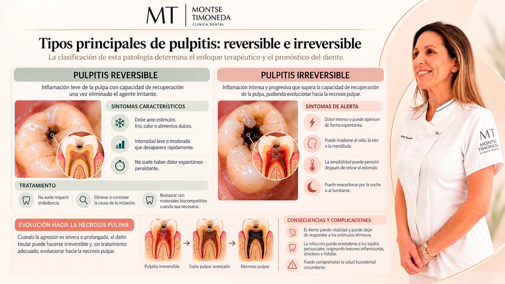 circundante | pulpitis