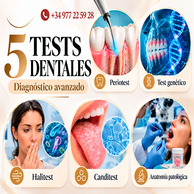 Cinco tests dentales avanzados | Pruebas diagnosticas en odontologia 5 tipos de tests para conocer mejor tu salud bucal